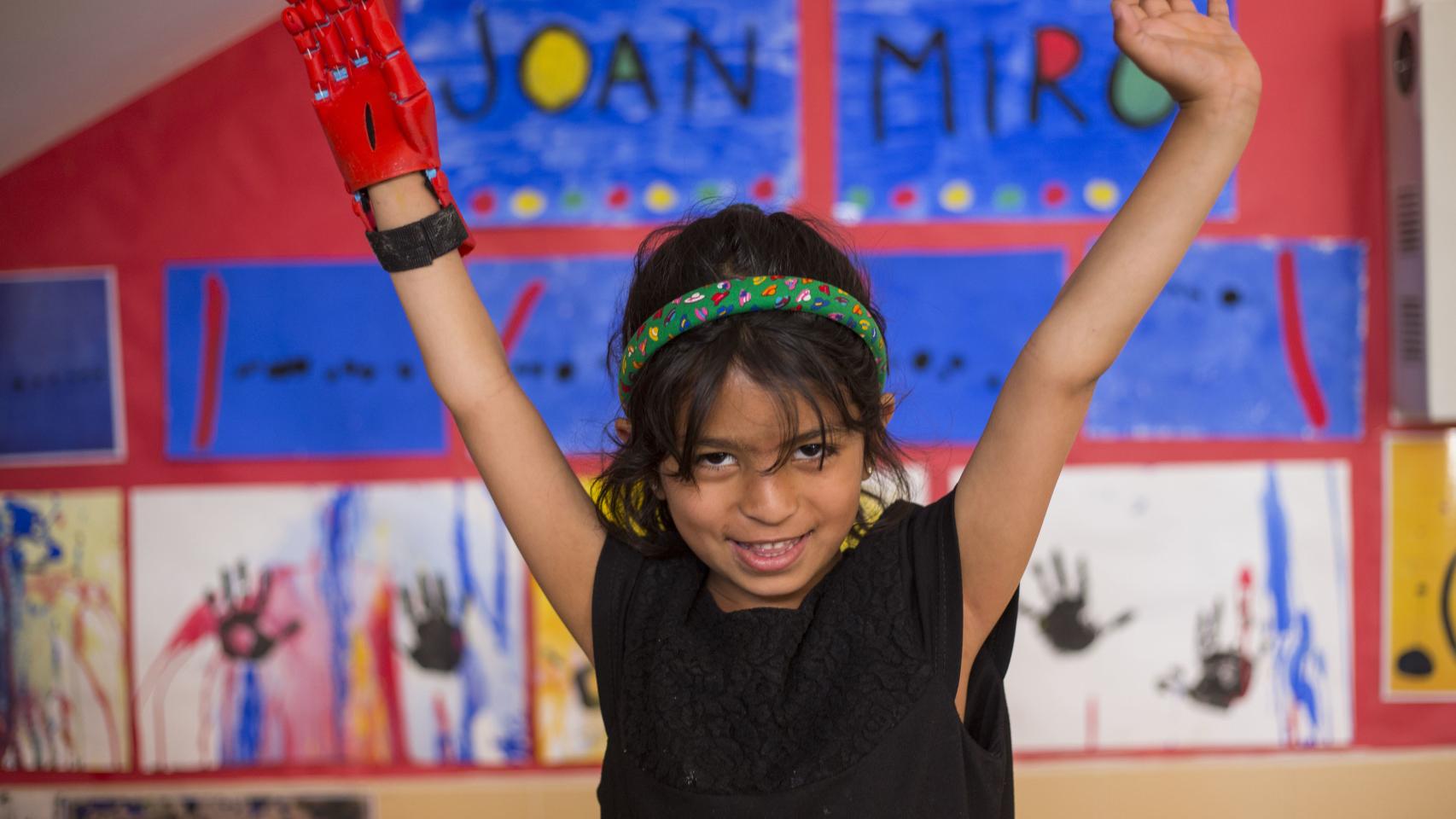 Mariam Sabar nació con una malformación en una de sus manos.