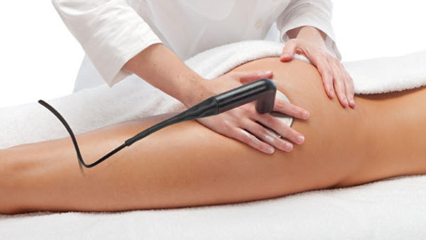 Aplicación del tratamiento Indiba.