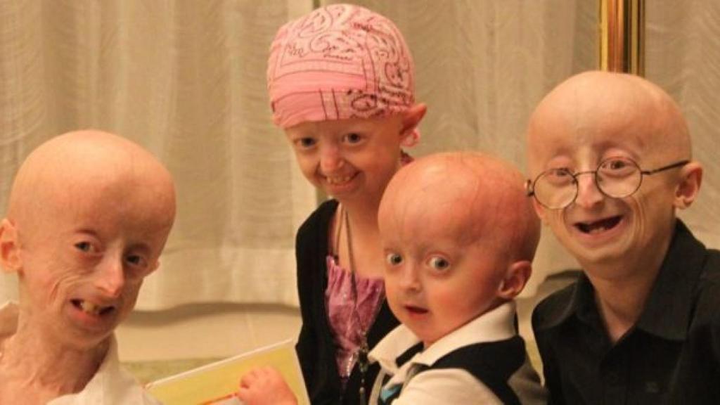progeria