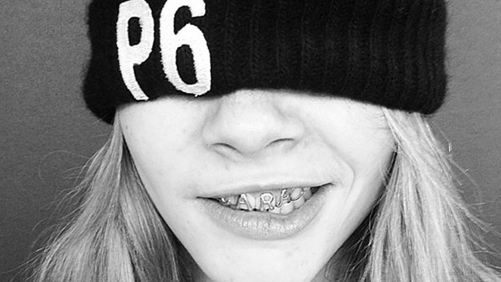 La modelo Cara Delenvigne, con su dentadura personalizada.