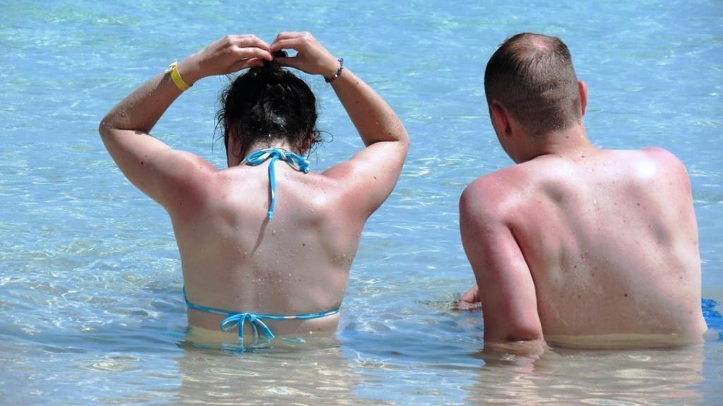 Bañistas al sol, con señales de haberse quemado la piel.