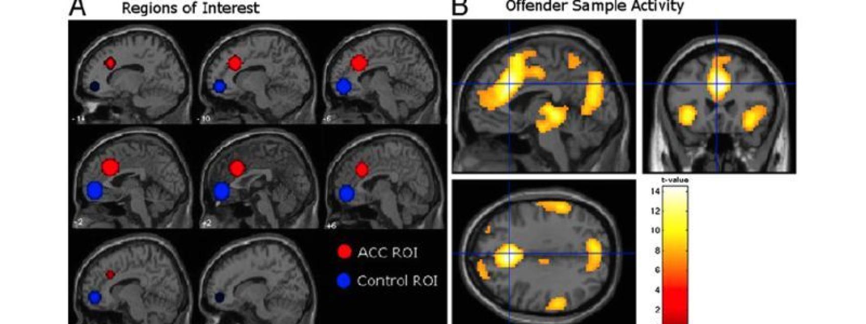 Así se diferencia el cerebro de un preso reincidente de otros.