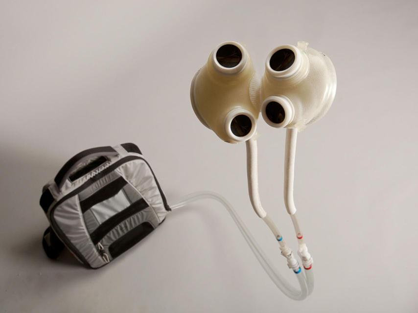 El modelo de asistencia ventricular, todo en una mochila.
