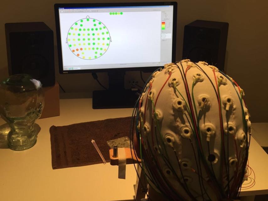 Los electrodos, en función de su conectividad.