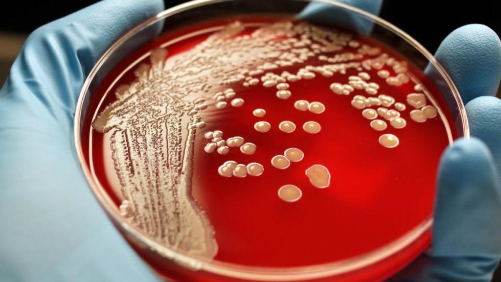 compuesto_antibacterias