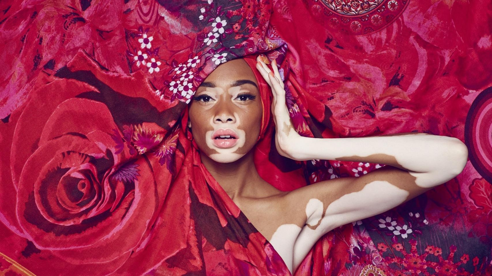 Una de las Imágenes de la campaña de Desigual protagonizada por Winnie Harlow.