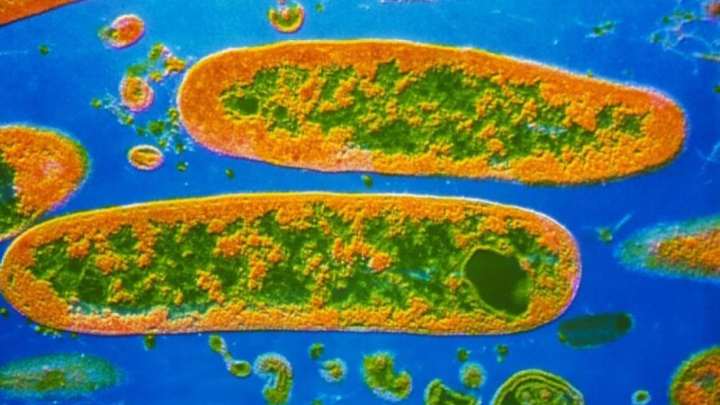 yersinia_pestis-680x479