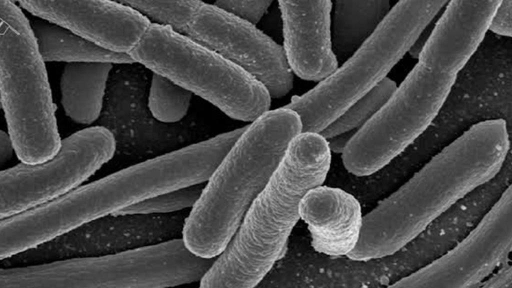 e_coli