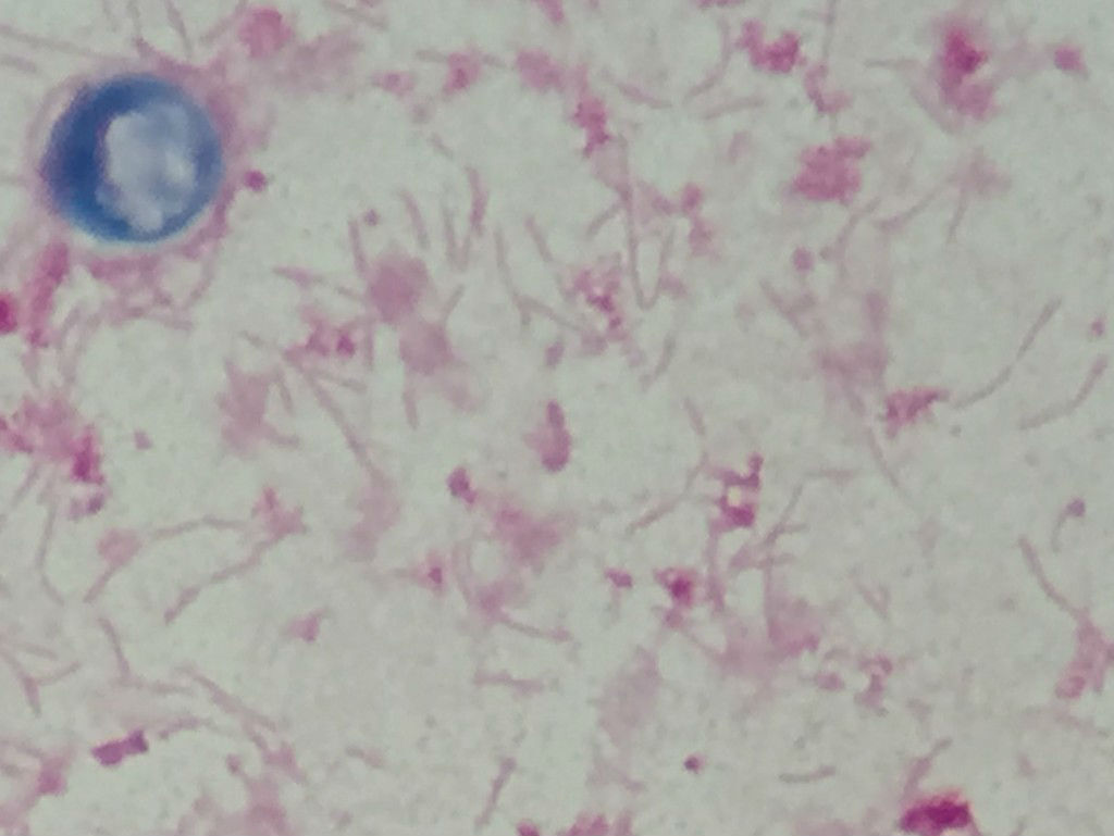 Capnocytophaga_canimorsus