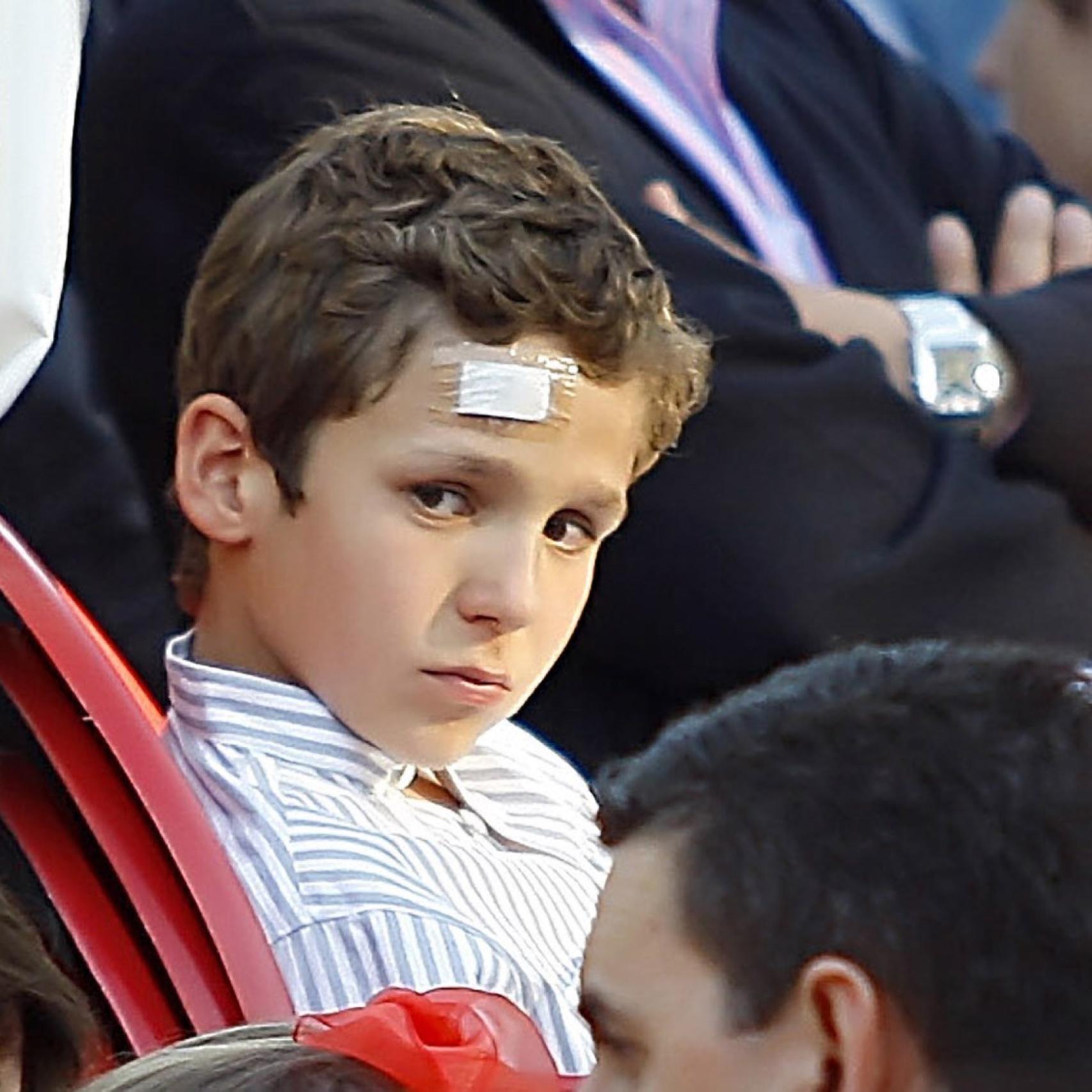 El hijo mayor de la infanta Elena, con una herida 'de guerra' en la frente.