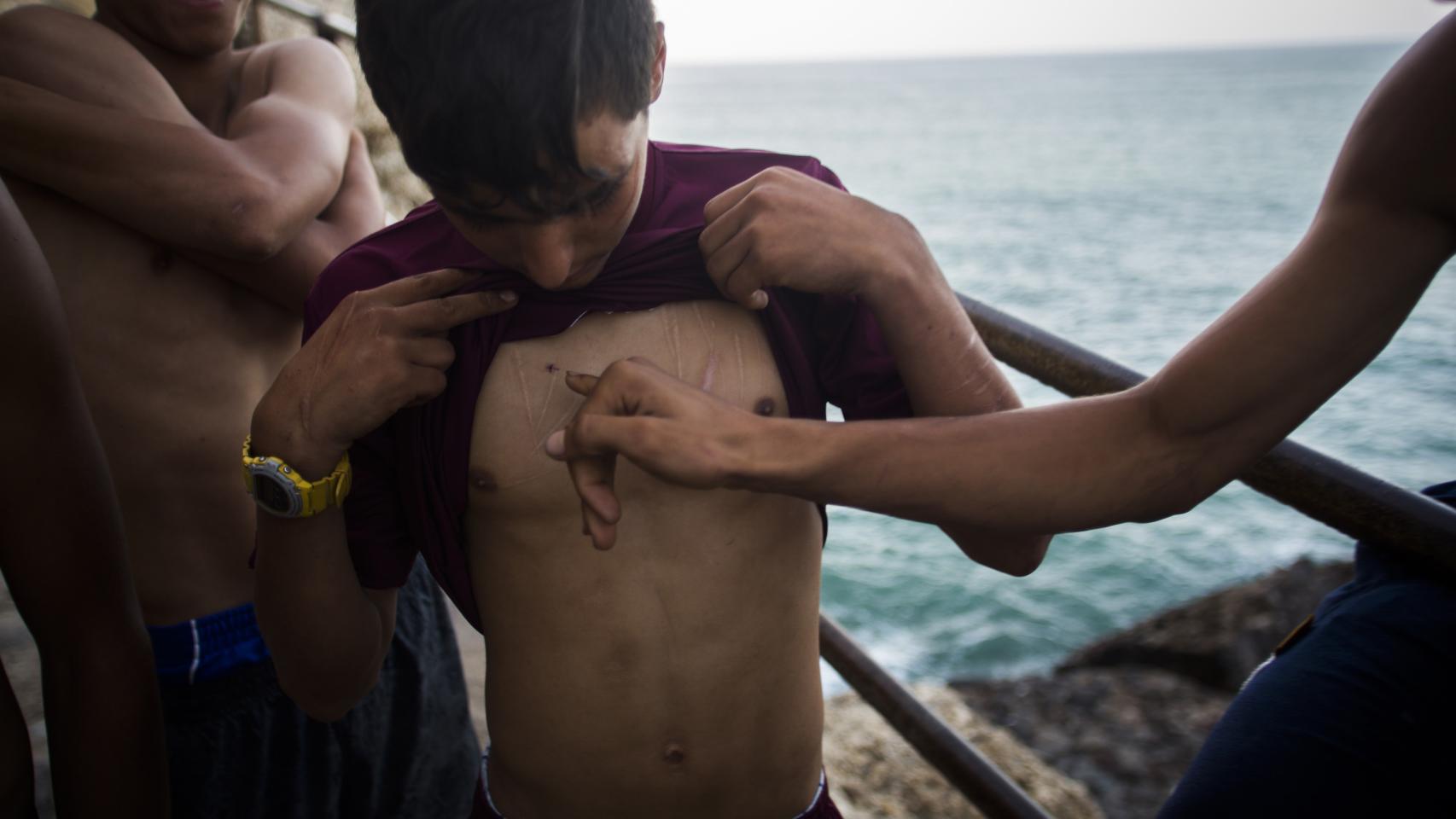 Osam muestra las cicatrices de los cortes sufridos en el pecho.