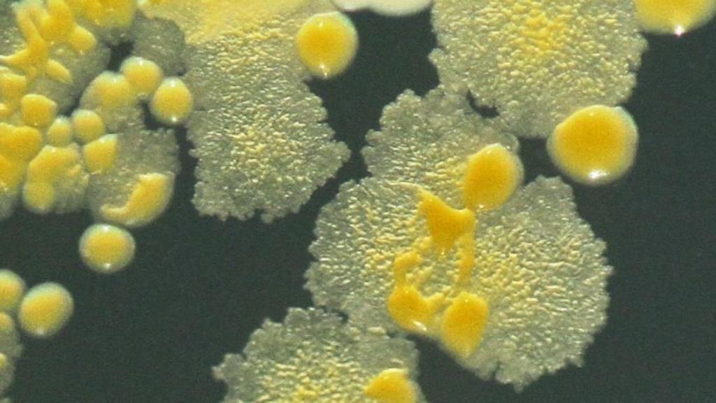 mycobacterium vaccae