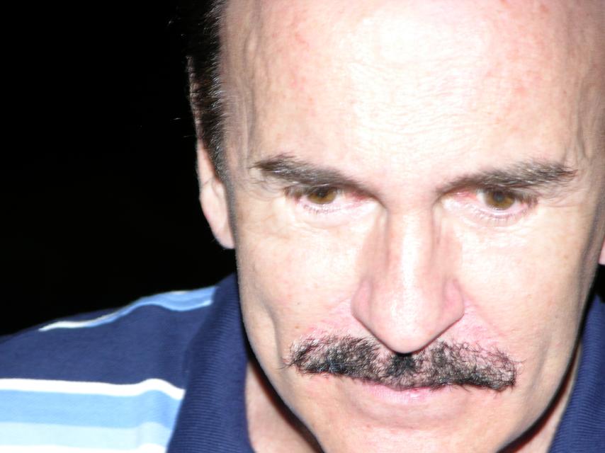 Primer plano de Carlos Llorca, después de sus dos operaciones estéticas.