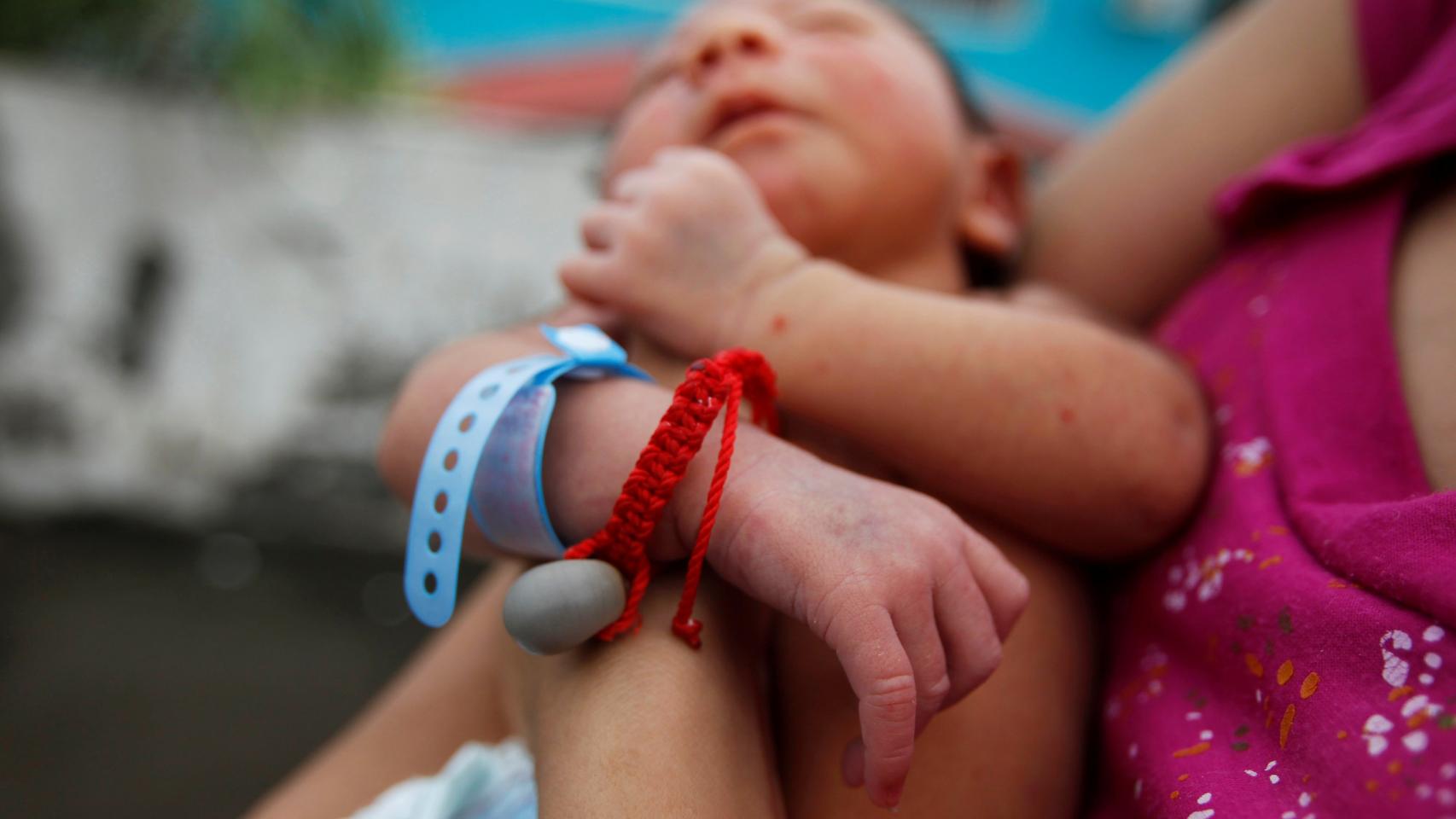 Allan, nacido con microcefalia en Choluteca, Honduras.