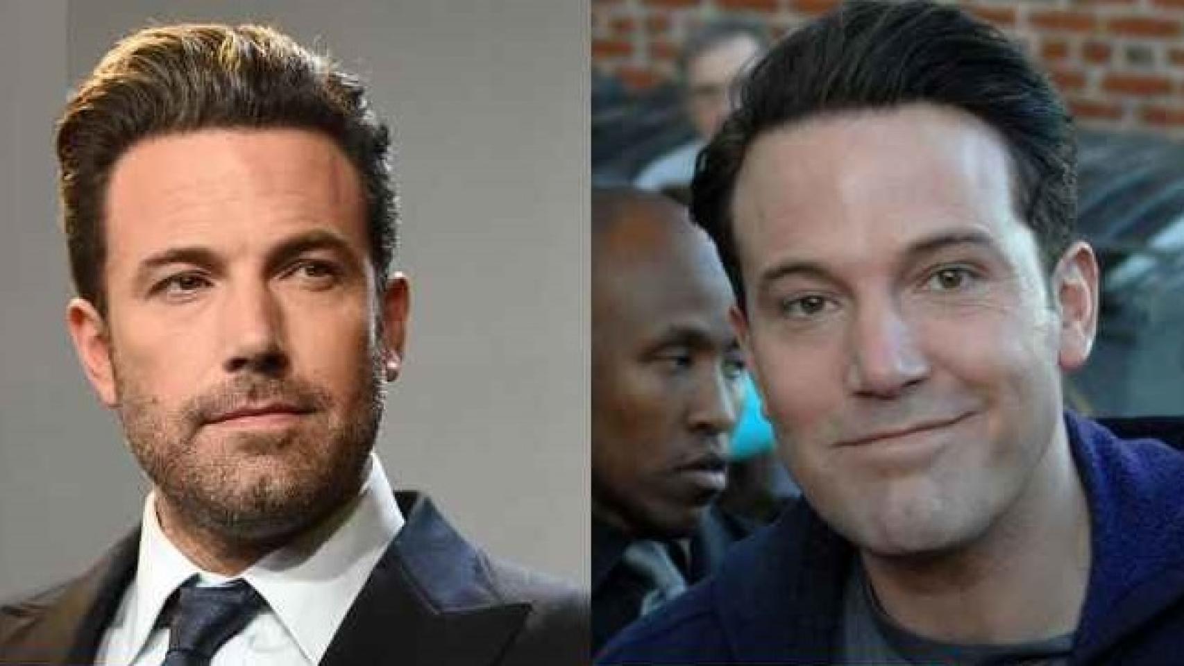 El antes y el después de la transformación facial de Ben Affleck.