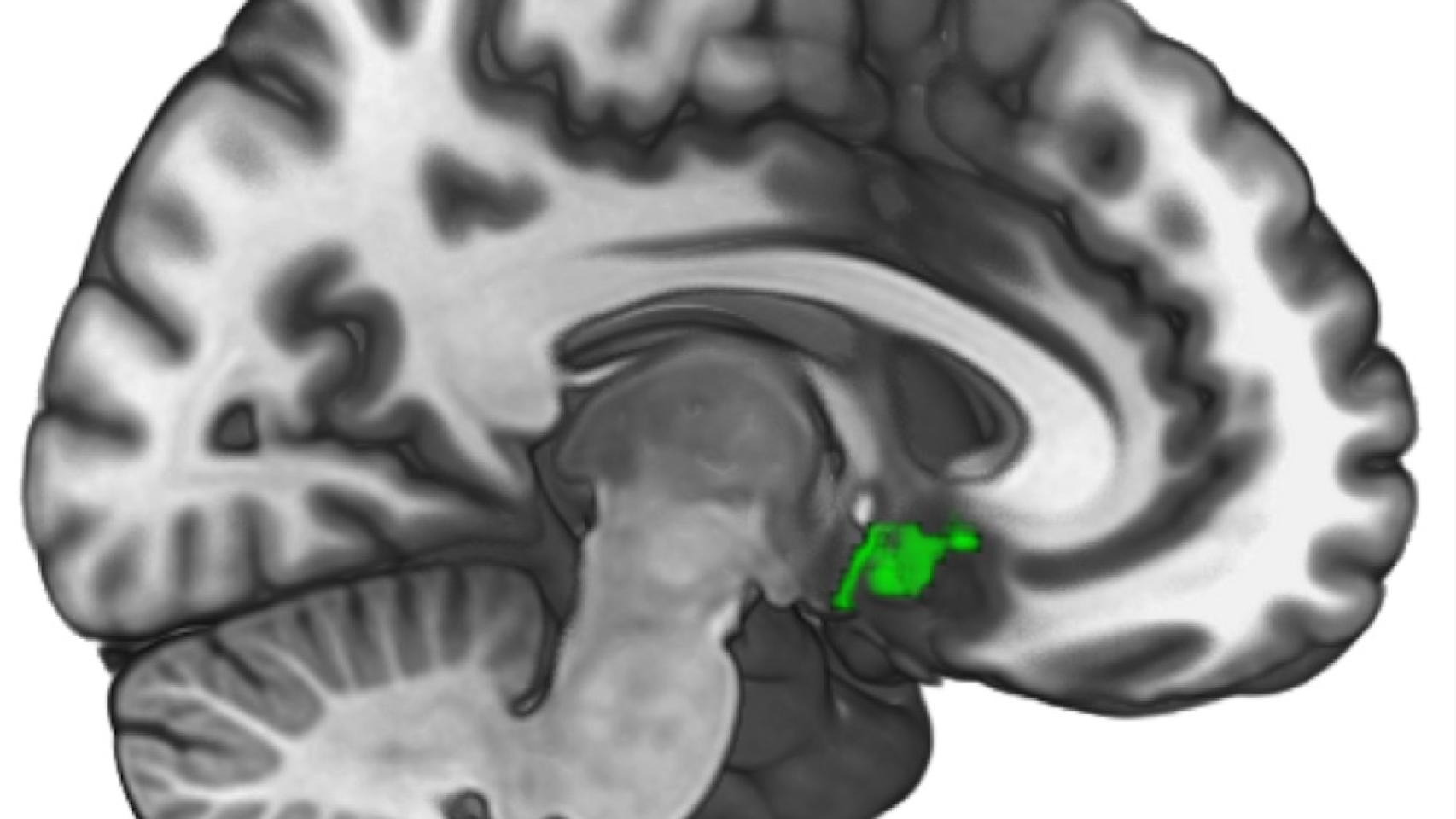 Esa pequeña región en verde es la que se ilumina cuando ayudamos a otros.