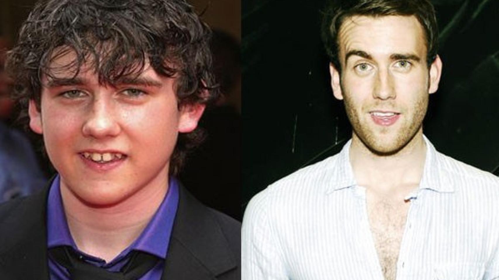 Matthew Lewis parece otro tras corregir su sonrisa.
