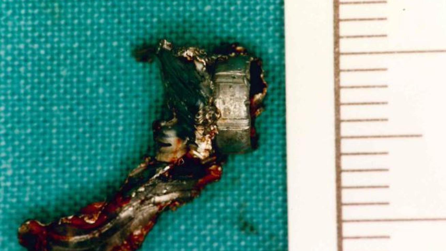 La bala que causó la muerte de Blanco. Fue la segunda que Txapote le disparó.