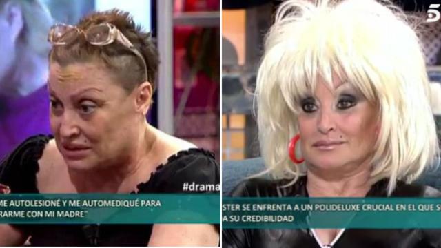 La extraordinaria recuperación de Aramis Fuster en sólo una semana