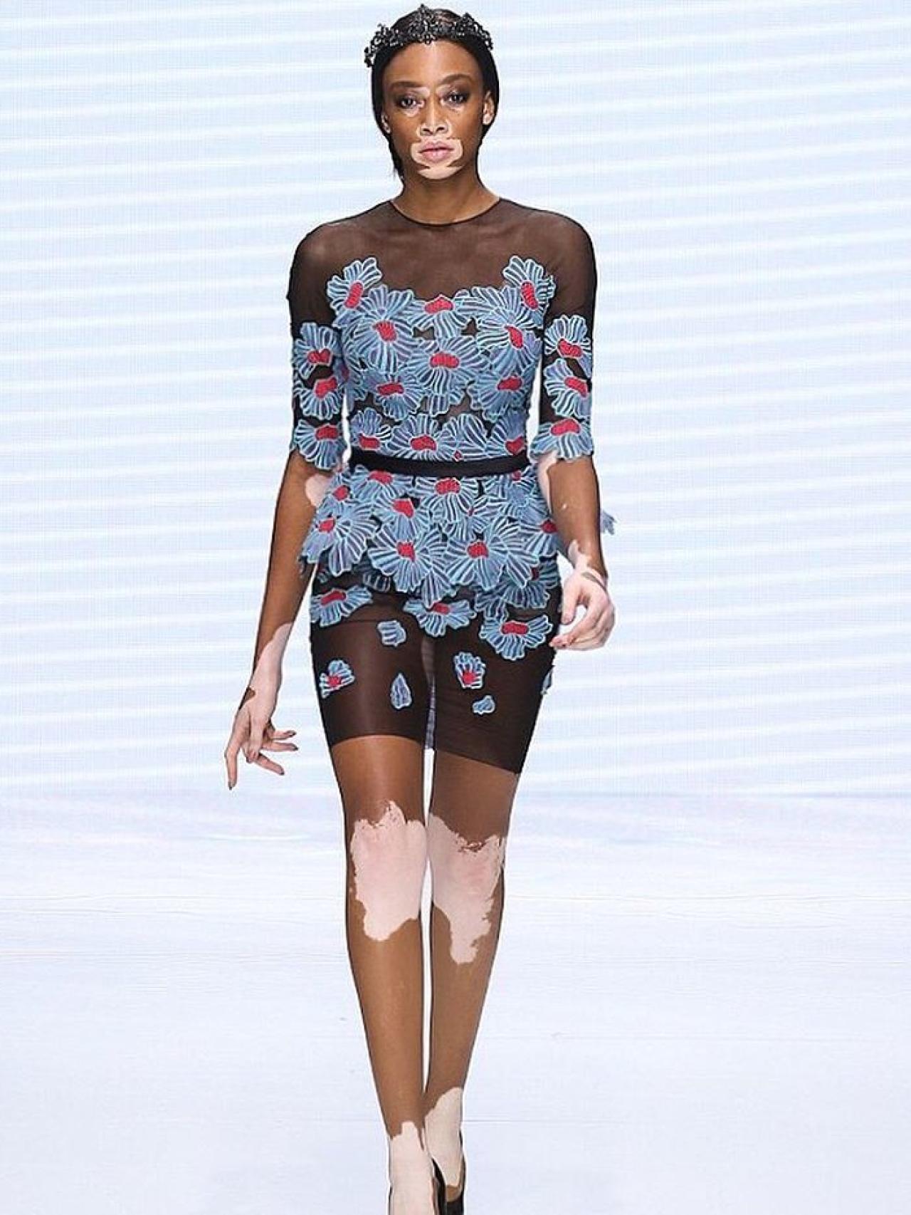 La modelo Winnie Harlow