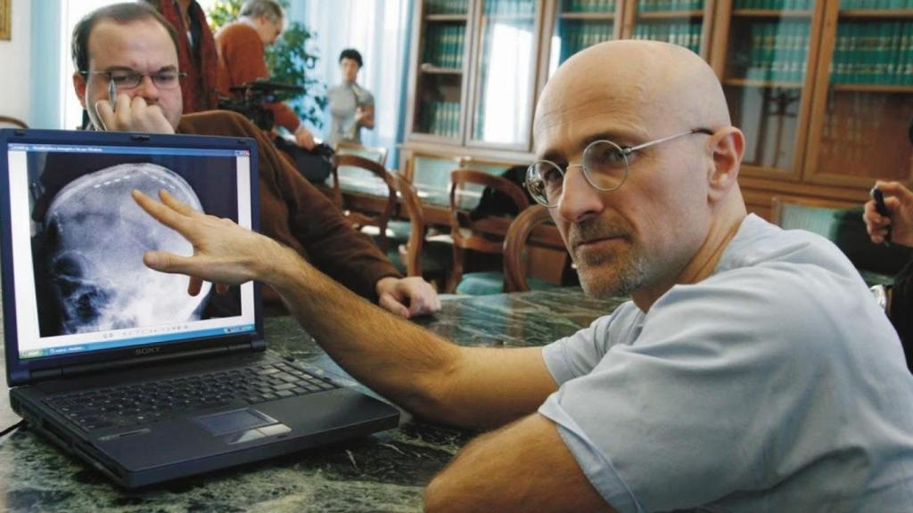 canavero-trasplante-de-cabeza