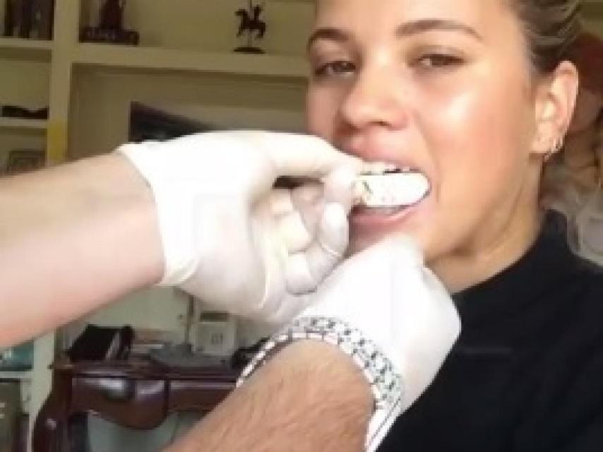 Sofia Richie preparándose para su nueva dentadura.