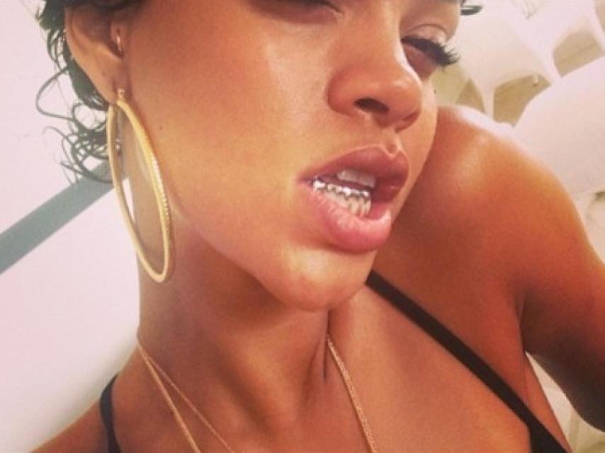 Rihanna con un toque de oro en su sonrisa.