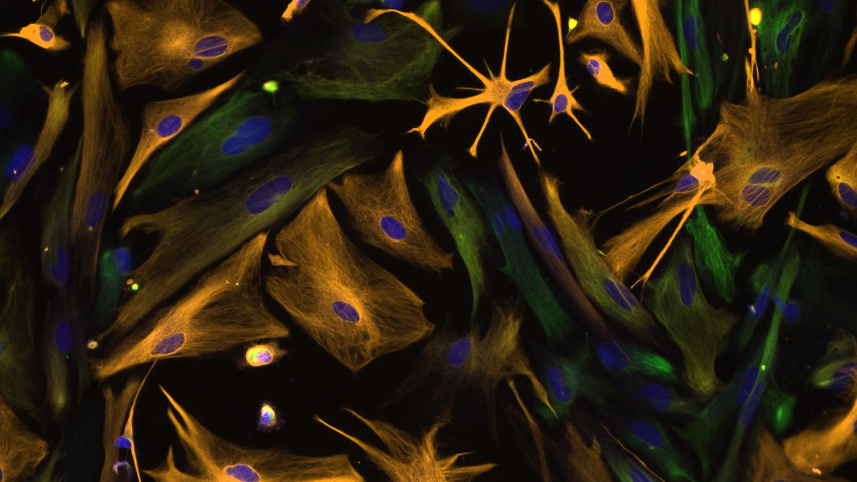 Progenitores neuronales.