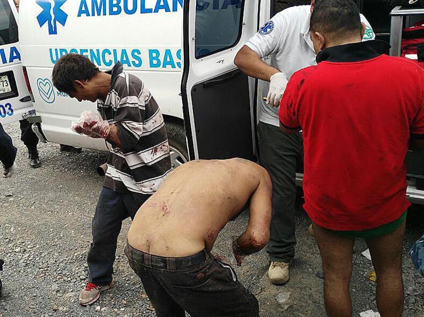 Paramédicos prestan los primeros auxilios a Ismael, de 34 años, a quien han amputado las dos manos.