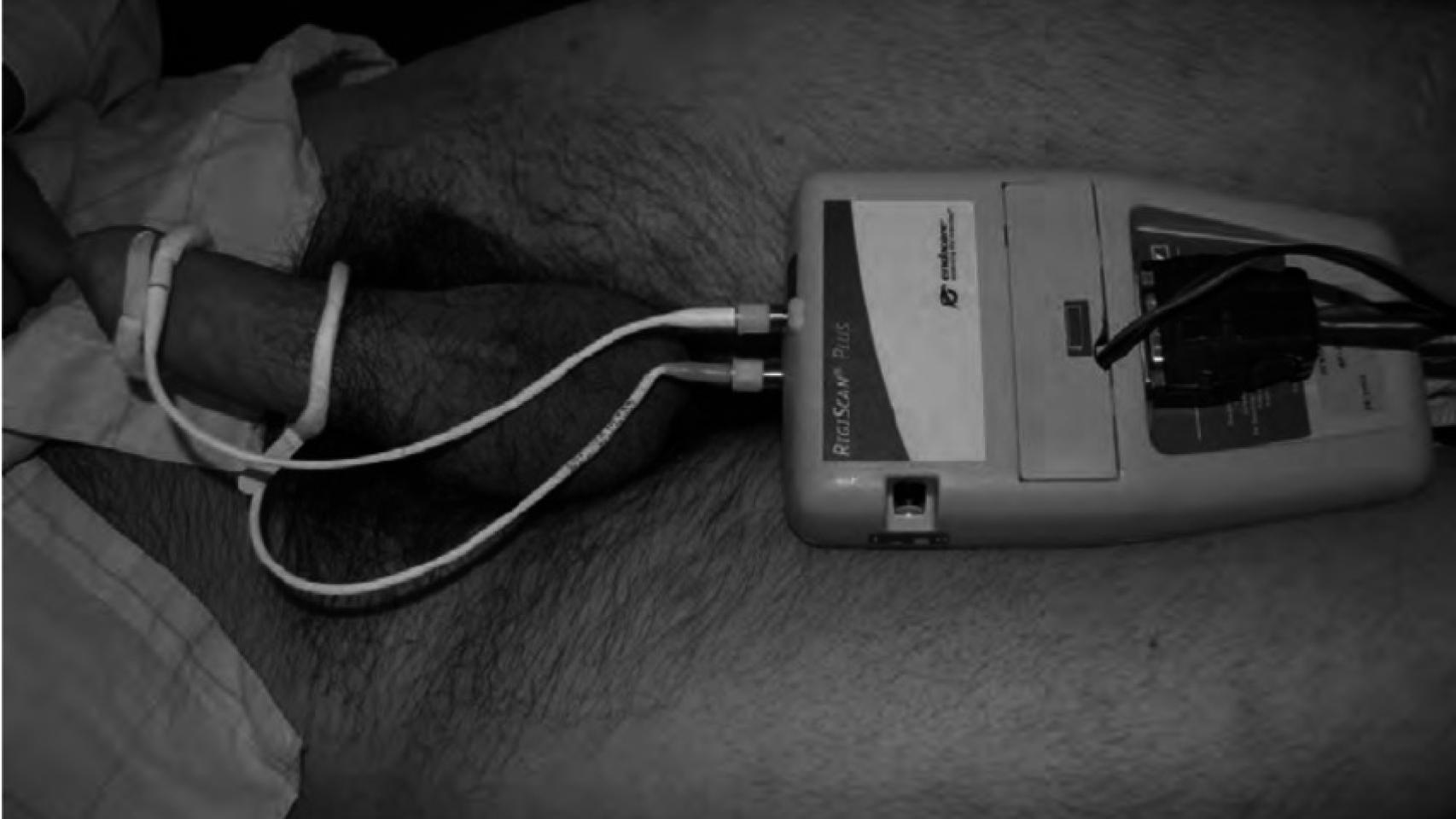 Un aparato RigiScan en funcionamiento.