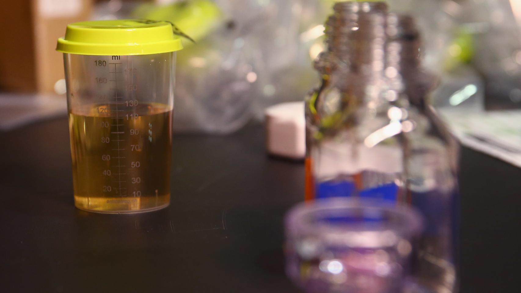 Control antidopaje en los últimos Europeos de atletismo.