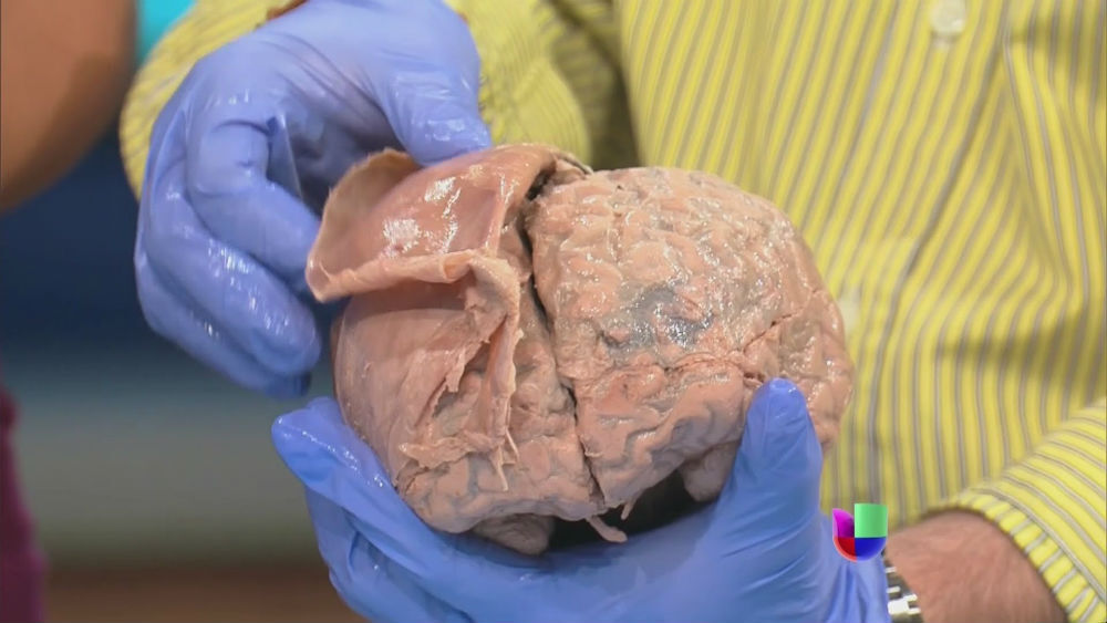 investigacion_alzheimer