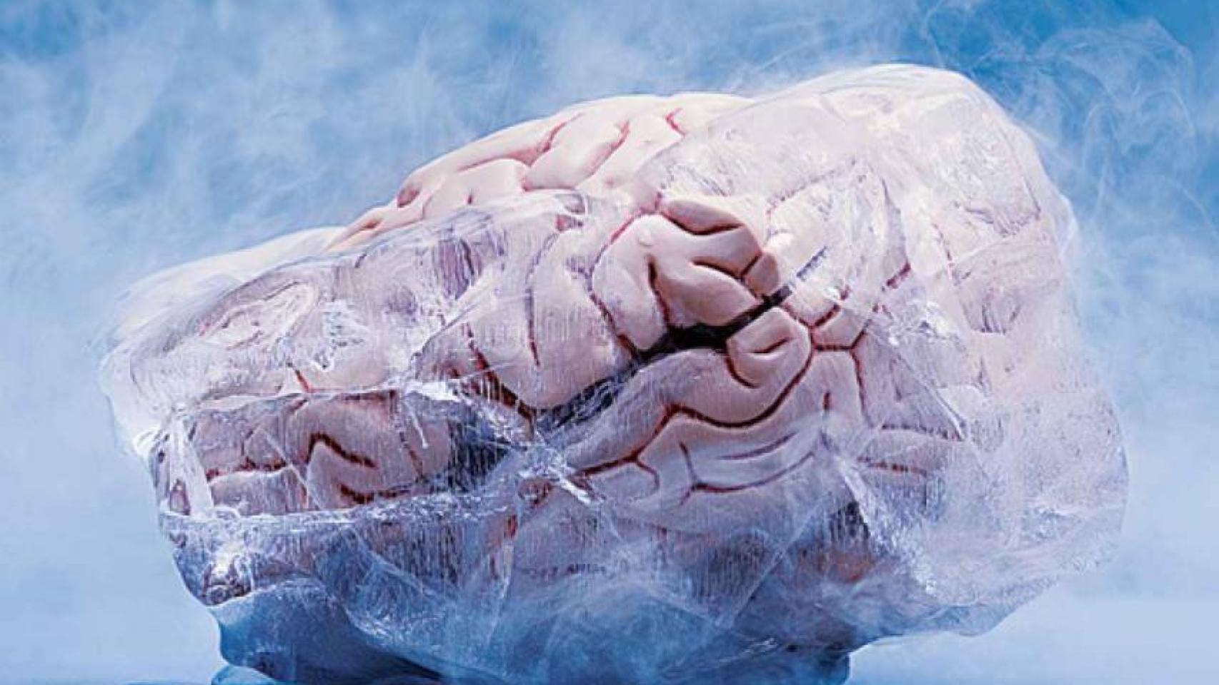 Una representación de un cerebro criopreservado