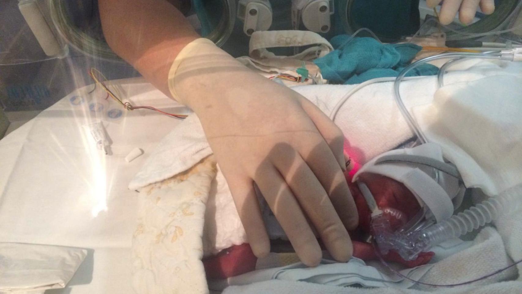 Ana a los pocos días de nacer