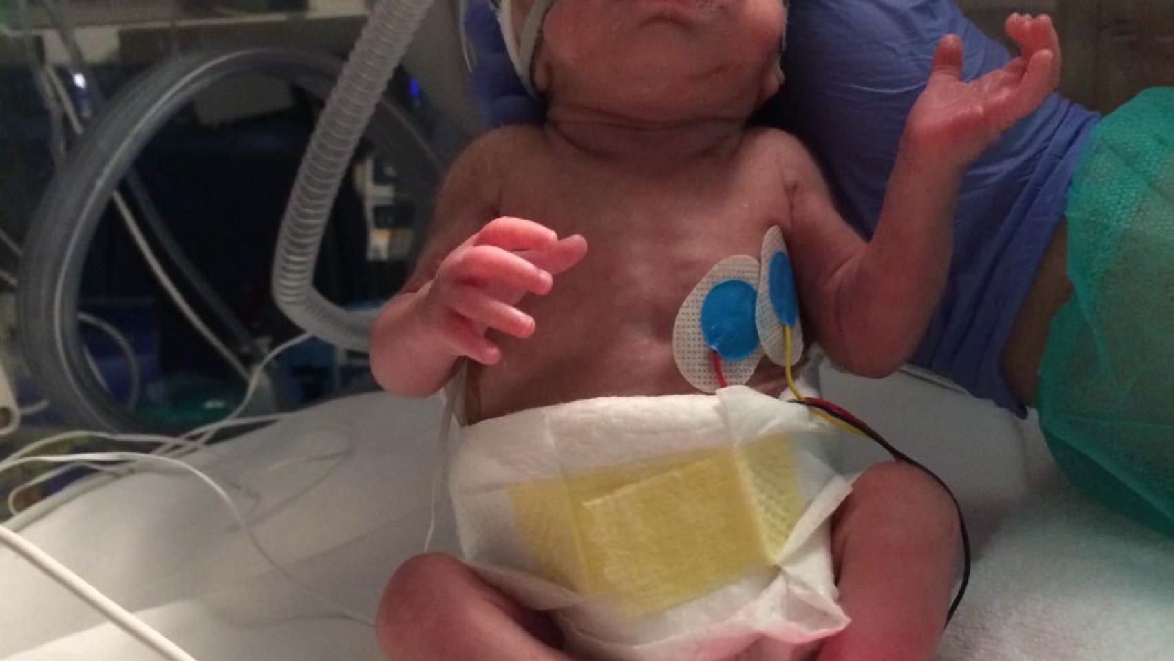 Ana, a los pocos días de nacer