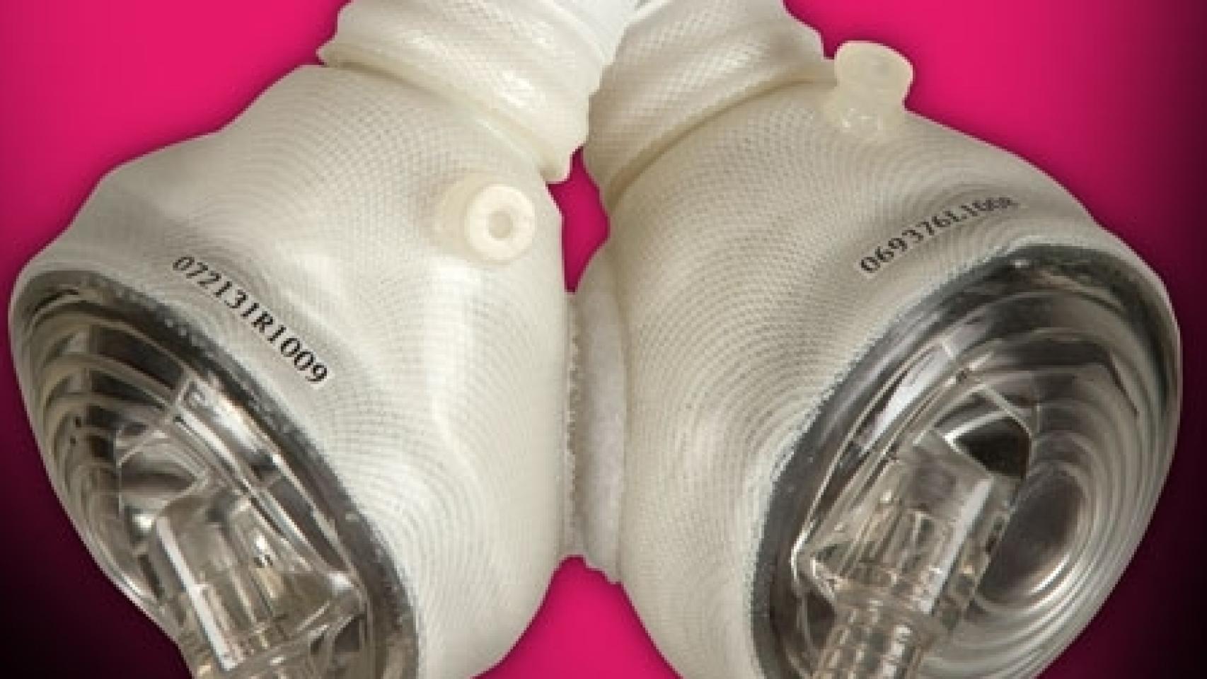 Dispositivo implantado en España.