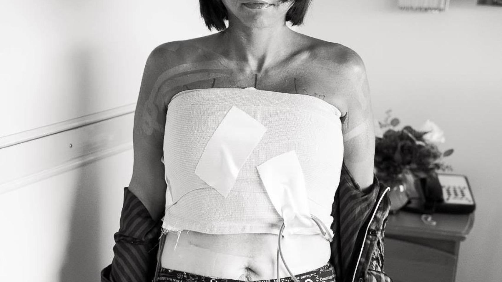 Anne Marie, trabajadora de Wisdo y superviviente de cáncer de mama