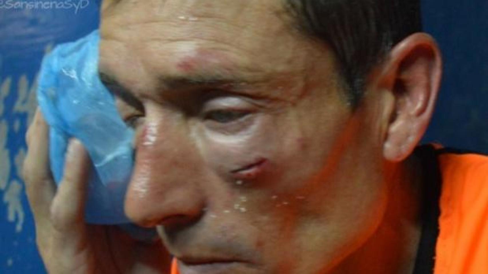 Claudio Elichiri, el árbitro agredido.