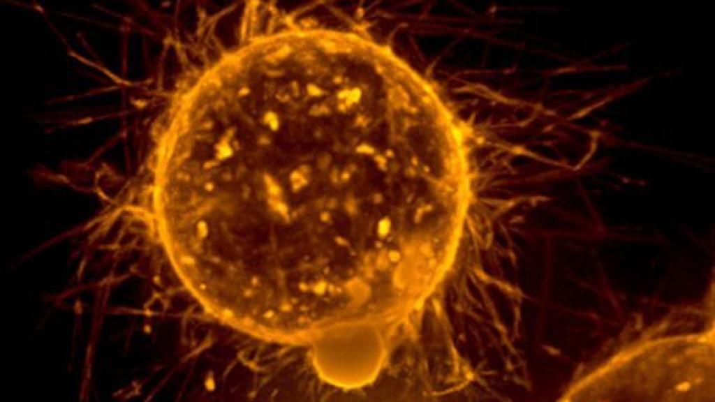 Image: Las grasas pueden tener la llave contra las metástasis