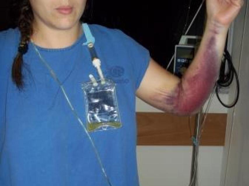 Ana Margarita sufrió un fallo multiorgánico tras la operación y estuvo un mes hospitalizada.