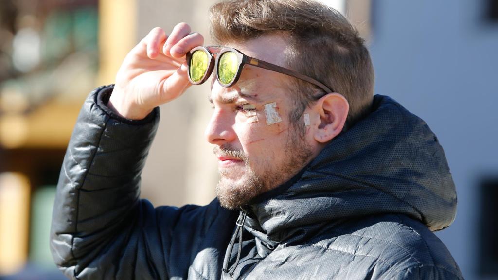 Al cantante le rompieron un vaso de cristal en la cara tras discutir con otro joven