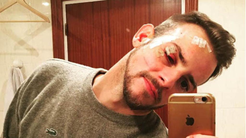 Alex Casademunt instagram