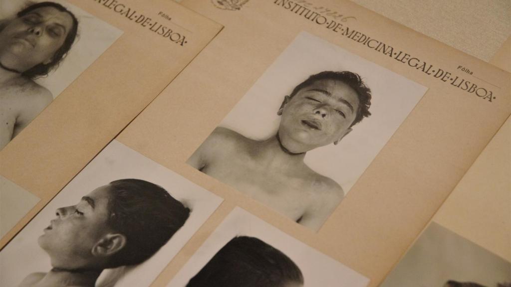 Archivos del Instituto de Medicina Legal de Lisboa. -