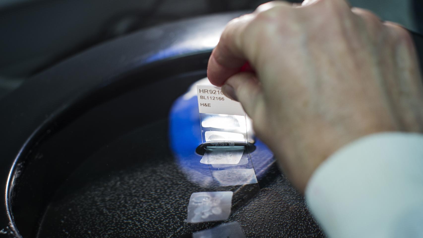 Una investigación contra el cáncer.