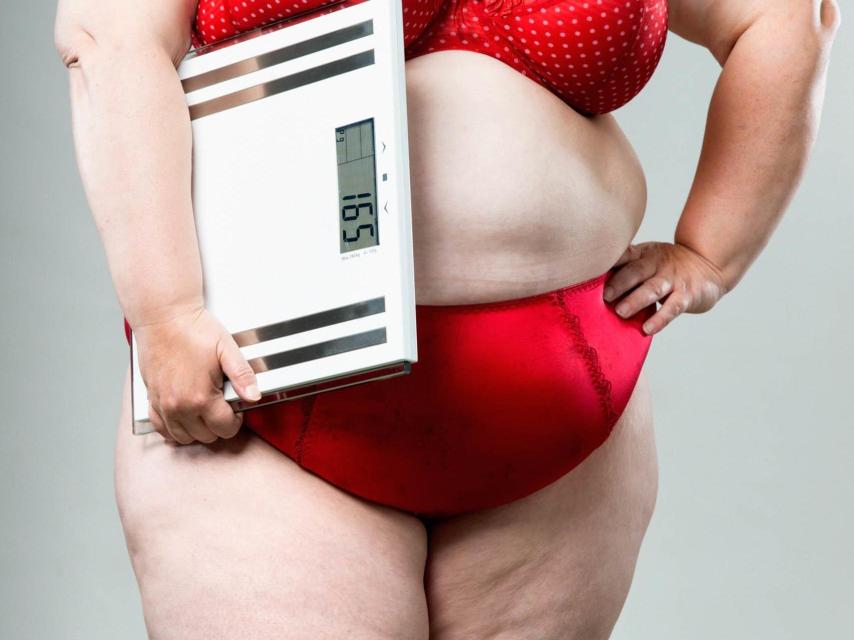 Mujer obesa.