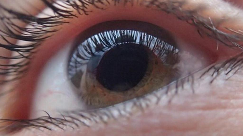 Trending-Topic-ojo-cataratas-operacion