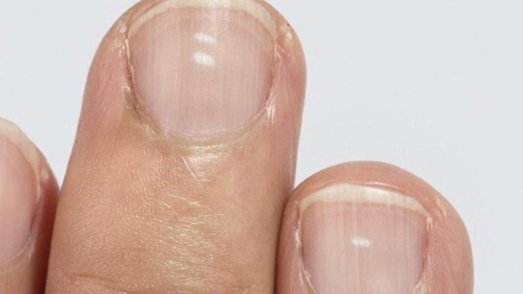 Trending-Topic-dedo-una-mancha