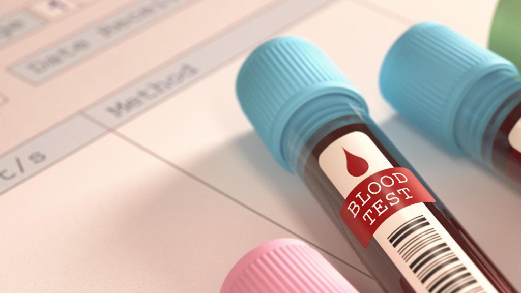 En un futuro lejano se podrá diagnosticar el autismo con un análisis.