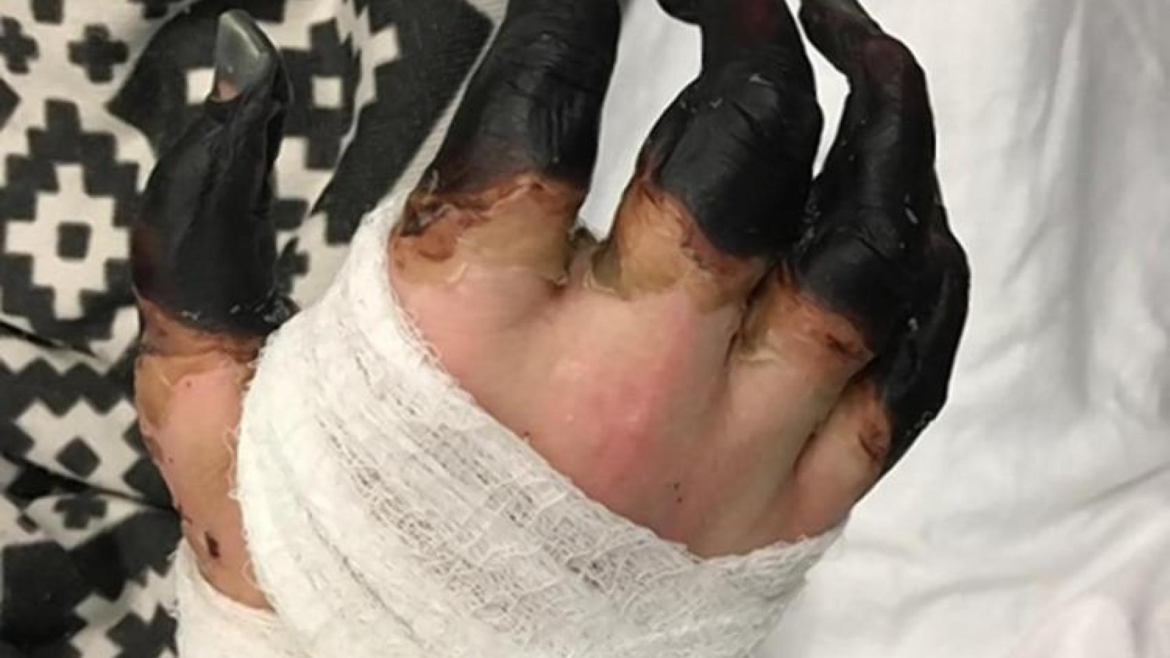 Así quedaron las manos del protagonista.