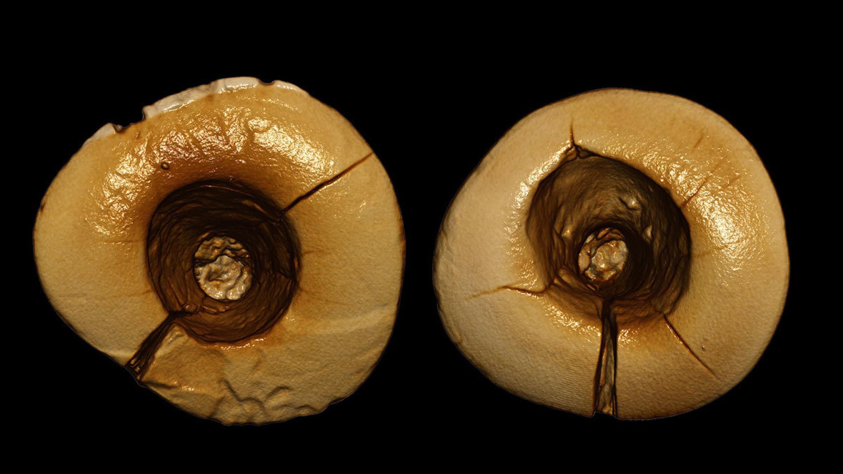 El relleno podría haber sido usado como antiséptico.